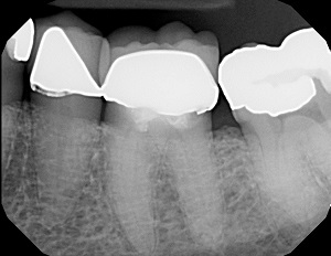 Lê mais sobre este artigo Dentaltown publica um recall de 70 anos