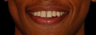 O sorriso restaurado de Yoseph
