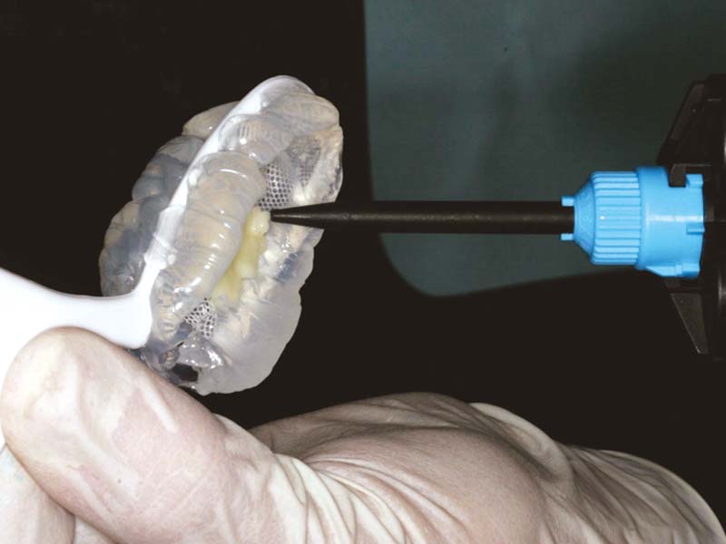 clinical-procedure2-tuff-temp-plus-2